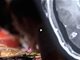 杭州大叔吃火锅肉片未涮熟  体内长满700条虫